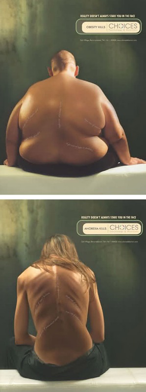 103 10 najšokantnijih kampanja protiv anoreksije