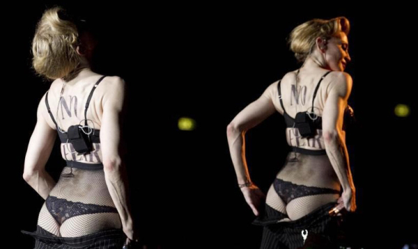 dupe Madonna nastavlja da pokazuje delove tela