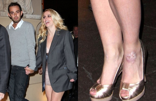 problem Trach Up: Britney pada s nogu