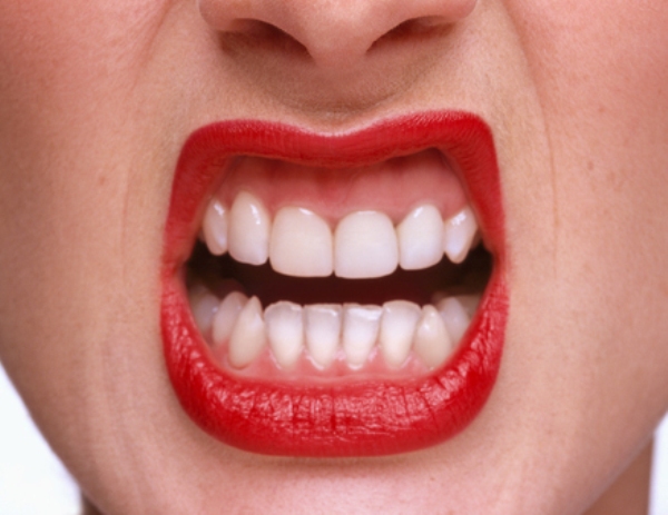 0719 beauty fixes 01 how to get red lipstick off teeth li Šest najjednostavnijih beauty rešenja