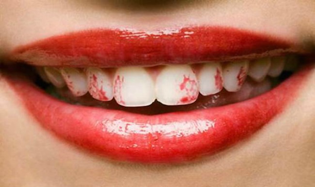 193 Kada šminka ne sarađuje: Karmin na zubima i ostale neprijatnosti
