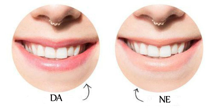 karmin beli zubi 51 Nijanse karmina sa kojima će vam zubi izgledati belje