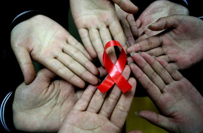 hiv aids 2 Predrasude koje ljudi imaju o osobama obolelim od side