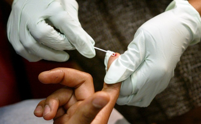 hiv testiranje Da li se protiv AIDS a borimo samo 1. decembra?