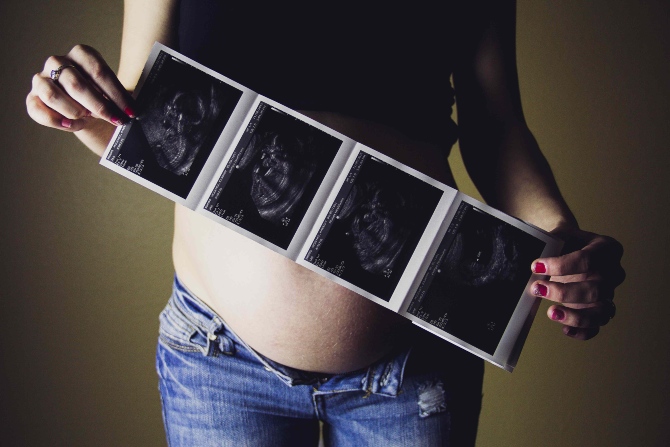 trudnoća 2 1 Koji horoskopski znaci najdramatičnije doživljavaju trudnoću