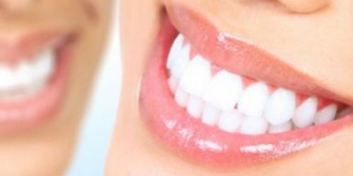 Sve što treba da znate o beljenju zuba