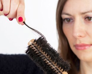 Telogen efluvijum: Drugi najčešći tip opadanja kose kod žena