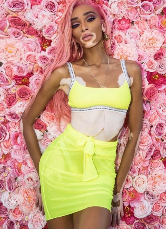 Think pink: Najbolje transformacije poznatih ličnosti u pink boju kose