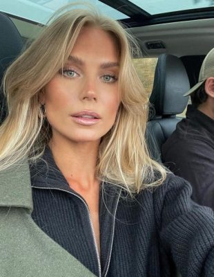 Zašto vam se stvaraju akne, iako odavno više niste u pubertetu