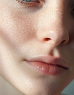 Evo kako smanjiti pore prema savetu dermatologa